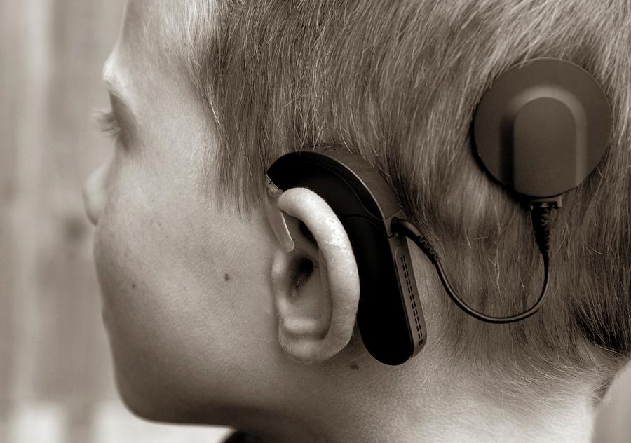 Device Photograph - Boy Fitted With Cochlear Implant by John Cole/science Photo Library