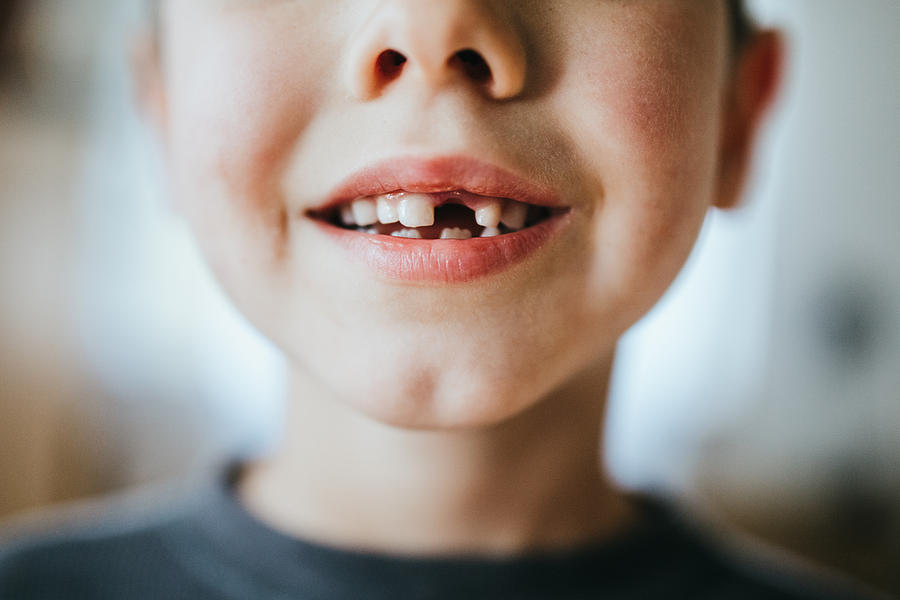 Boy Shows Off Missing Tooth Photograph by RyanJLane