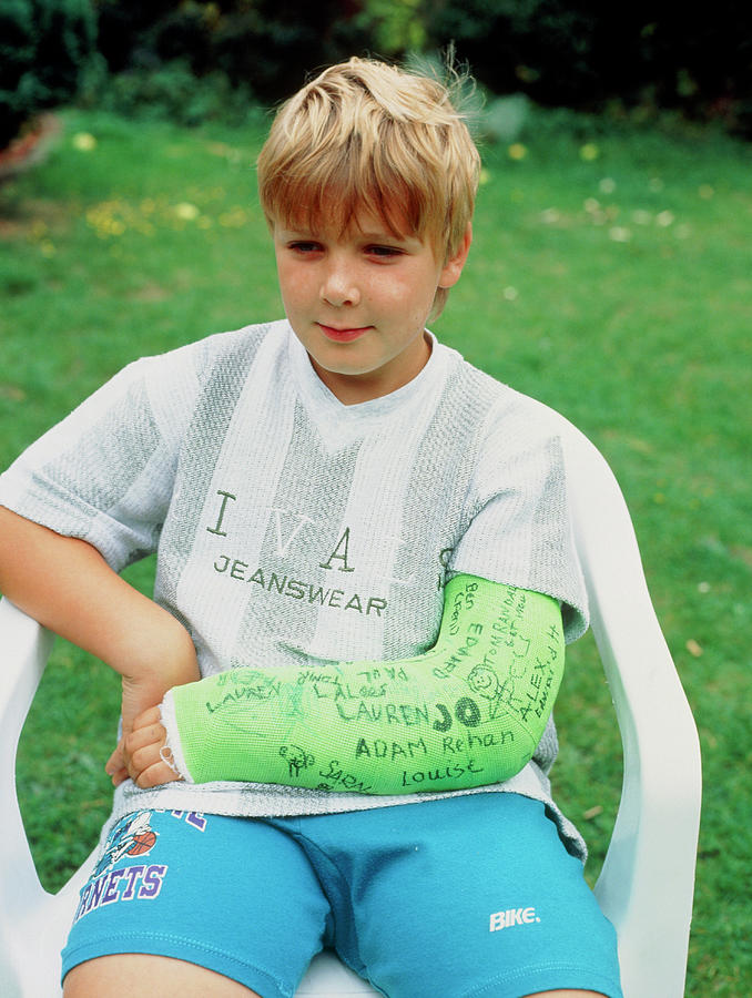 Boy Sits With Arm Im Plaster For Broken Wrist Photograph by Jim Selby ...