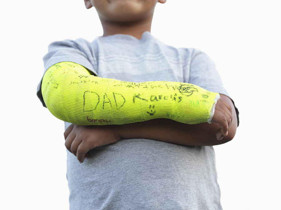 Boy with broken arm in yellow cast Photograph by Steven Puetzer