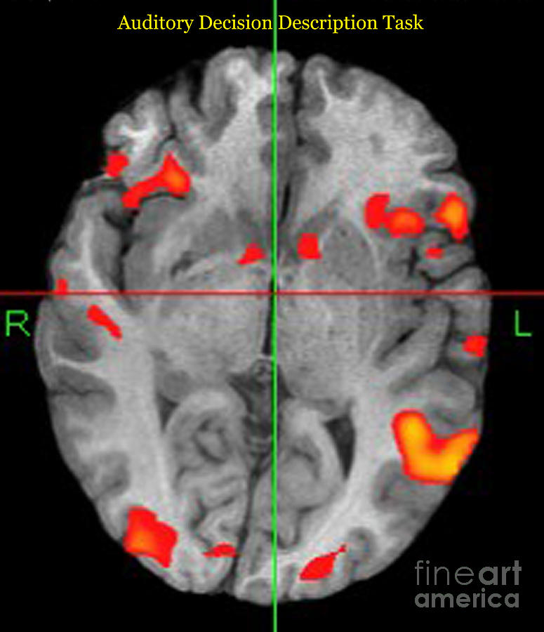 Brain Activity During Language Task, 2 Photograph by Living Art Enterprises