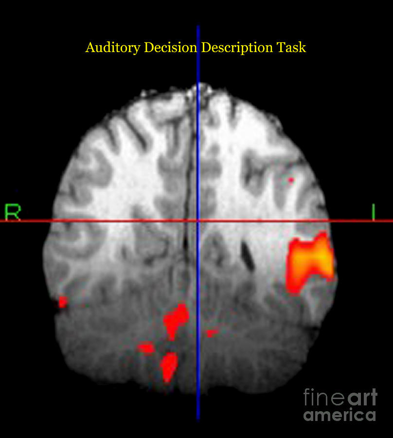 Brain Activity During Language Task, 3 Photograph by Living Art Enterprises