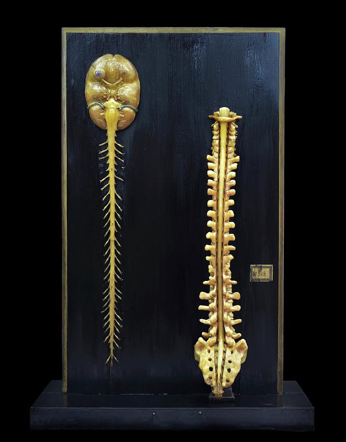 Brain And Spinal Cord Model Photograph by Javier Trueba/msf