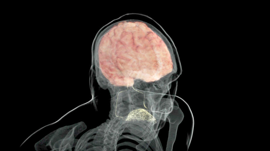 Brain And Taste Receptors, Superior View Photograph by Anatomical Travelogue