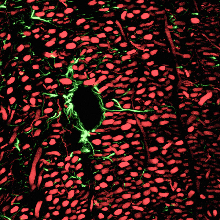 Brain Blood Vessels Photograph by C.j.guerin, Phd, Mrc Toxicology Unit/ Science Photo Library