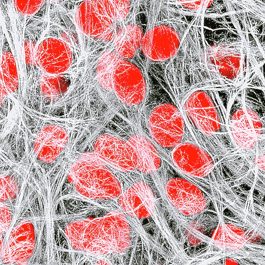 Brain Cells Photograph by Dr. Chris Henstridge
