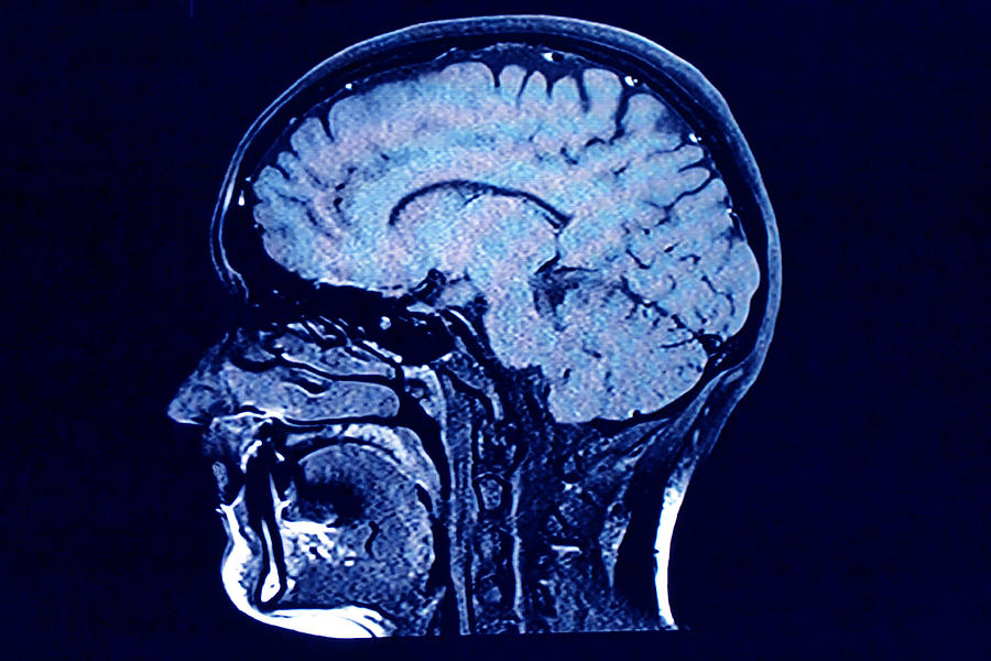Brain head scan Photograph by Roxana Wegner
