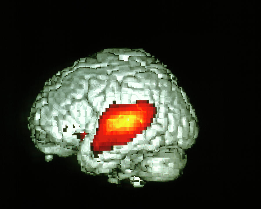 Brain Hearing Sound Photograph by Wellcome Dept. Of Cognitive Neurology/ Science Photo Library