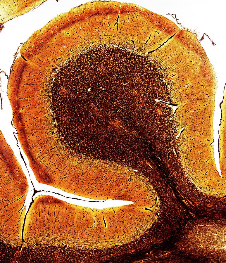Brain Photograph by Microscape