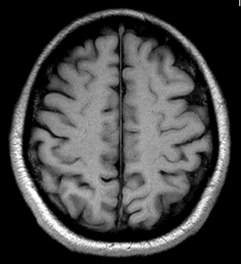 Brain MRI Photograph by Julie Toy