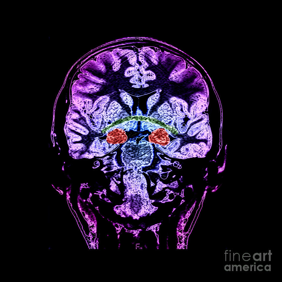 Brain, Mri Photograph by Living Art Enterprises