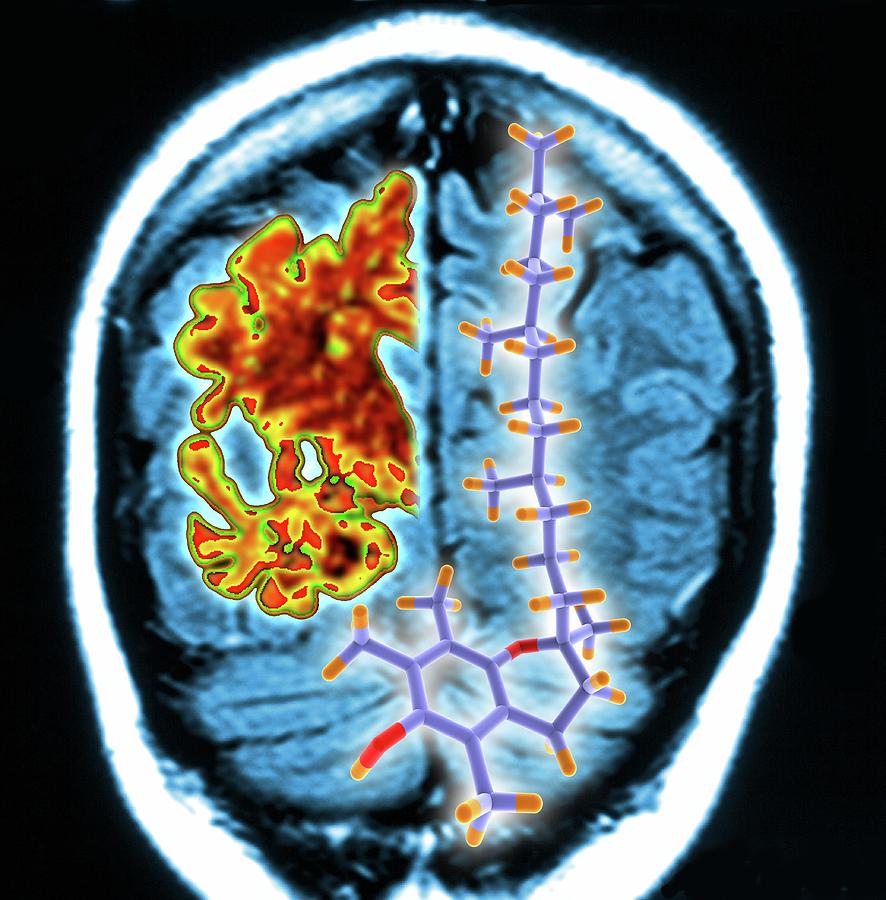 Brain Mri Scan And Vitamin E Molecule Photograph by Alfred Pasieka