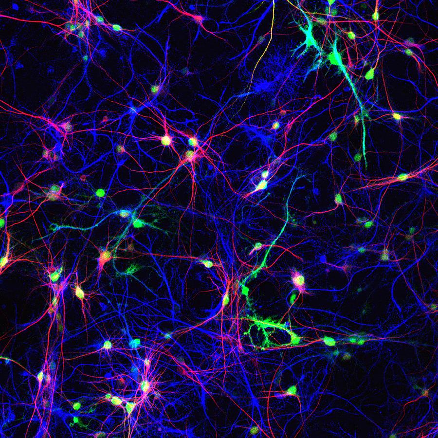 Brain Nerve Cells Photograph by Patrick Landmann/science Photo Library