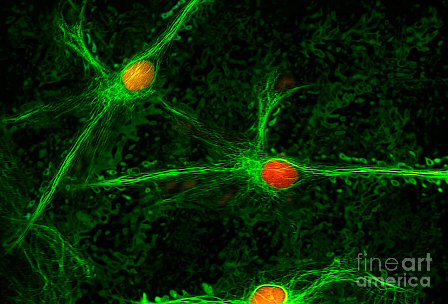 Brain Neurons Photograph by Mike Agliolo