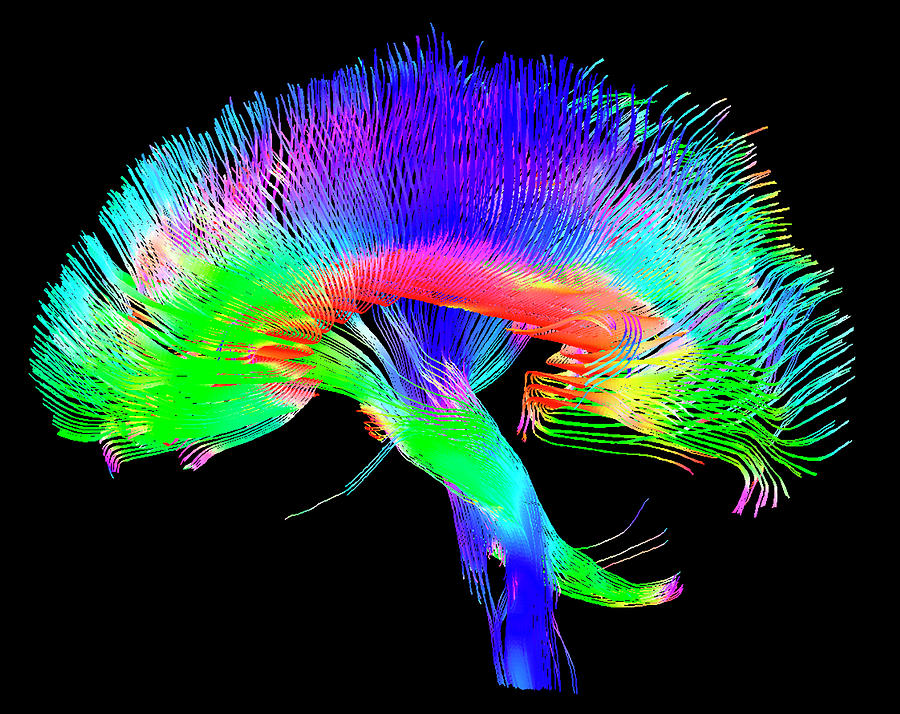 Map Photograph - Brain Pathways by Tom Barrick, Chris Clark, Sghms