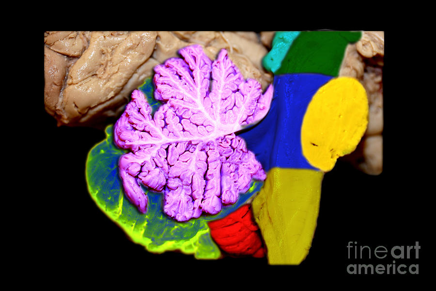 Brainstem, Cerebellum And Occipital Lobe Photograph by Living Art Enterprises