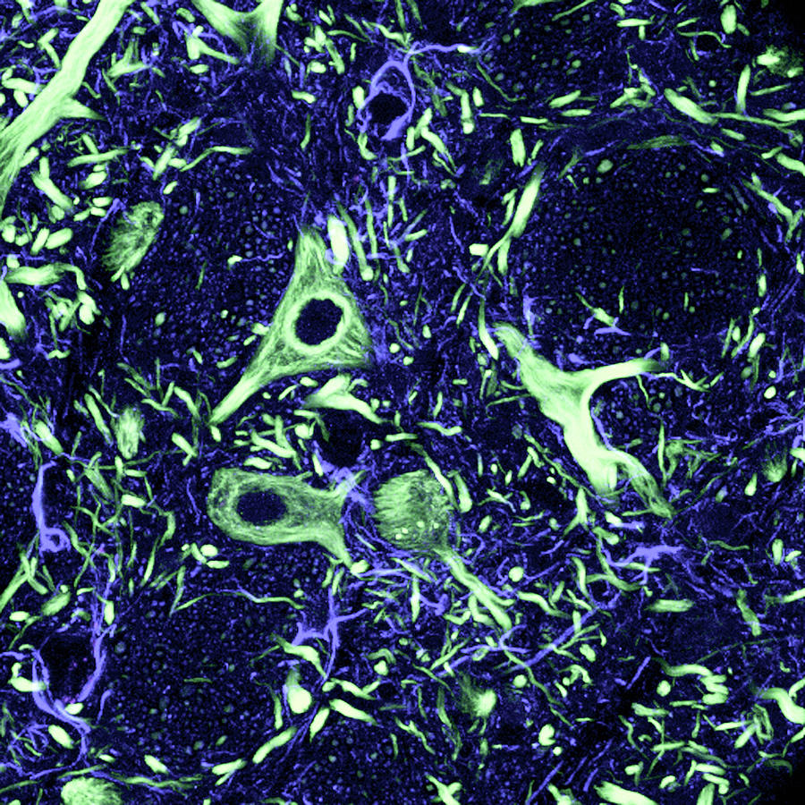 Brainstem Nerve Cells Photograph by C.j.guerin, Phd, Mrc Toxicology Unit/ Science Photo Library