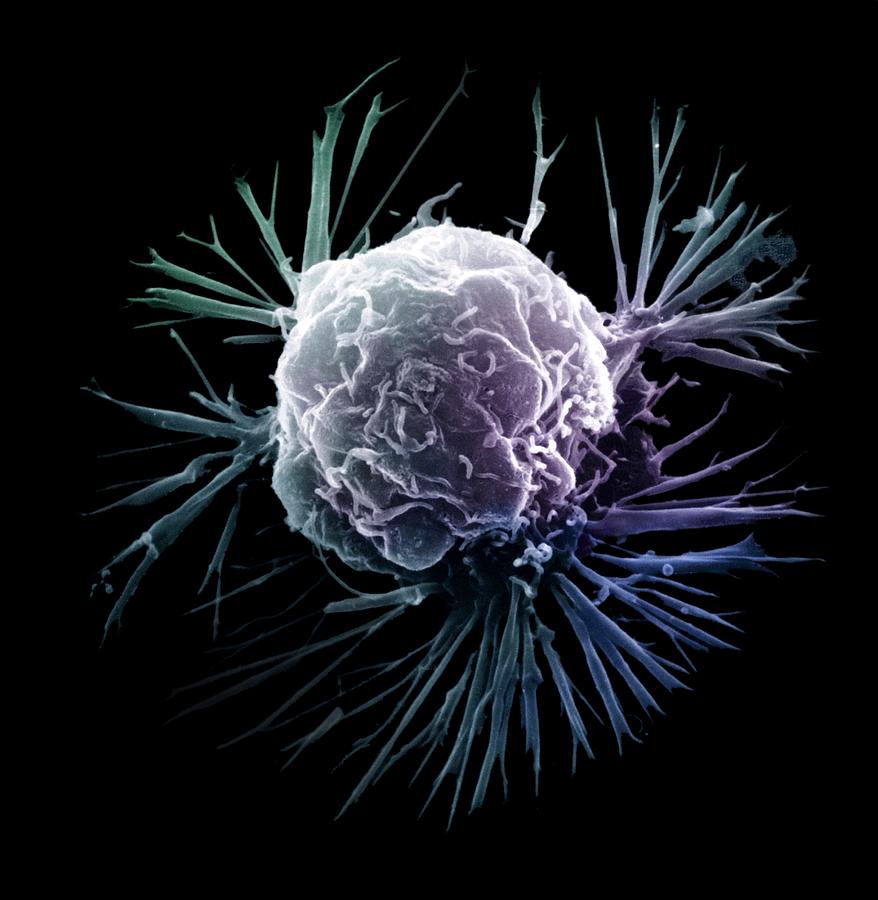 Breast Cancer Cell Photograph By Ami Images/science Photo Library - Pixels