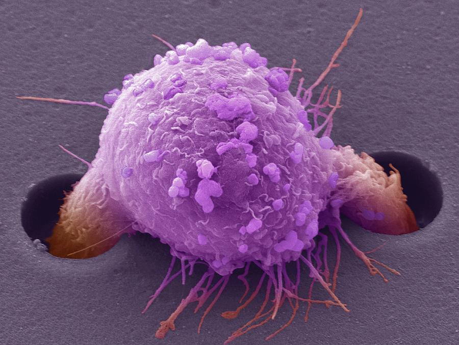 Раковые клетки передаются. Steve Gschmeissner Cell. Cancer Cell. Cancer Cell breast Cancer.