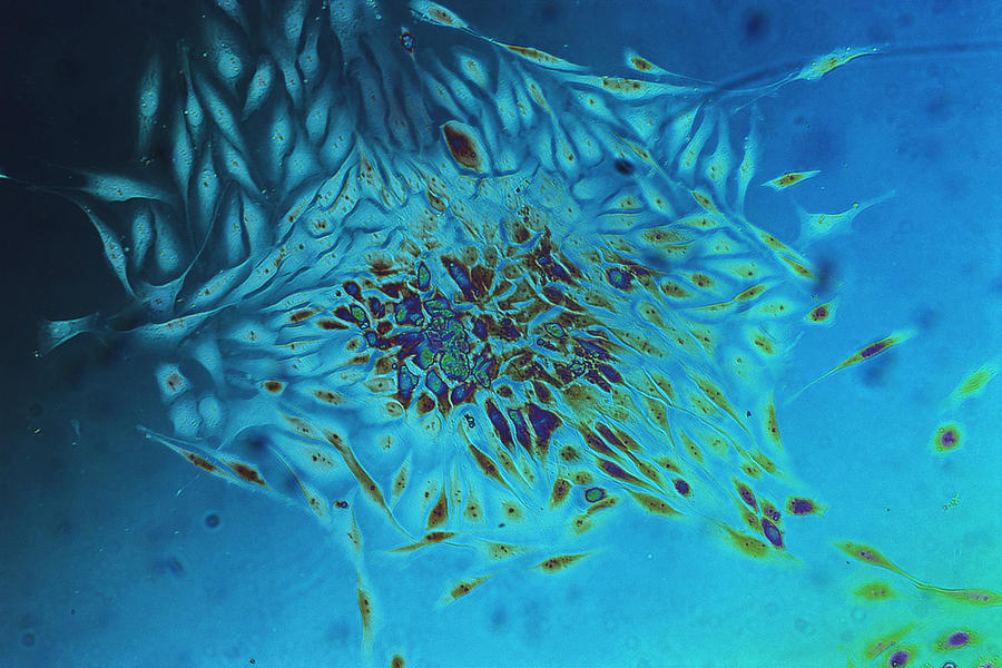 Breast Cancer Cells, Lm Photograph by Dr. Cecil H. Fox