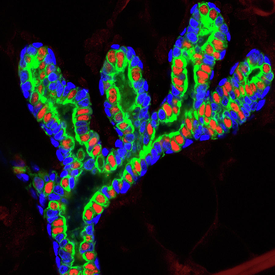 Breast Cancer Linked Gene Expression Photograph By Salk Institute