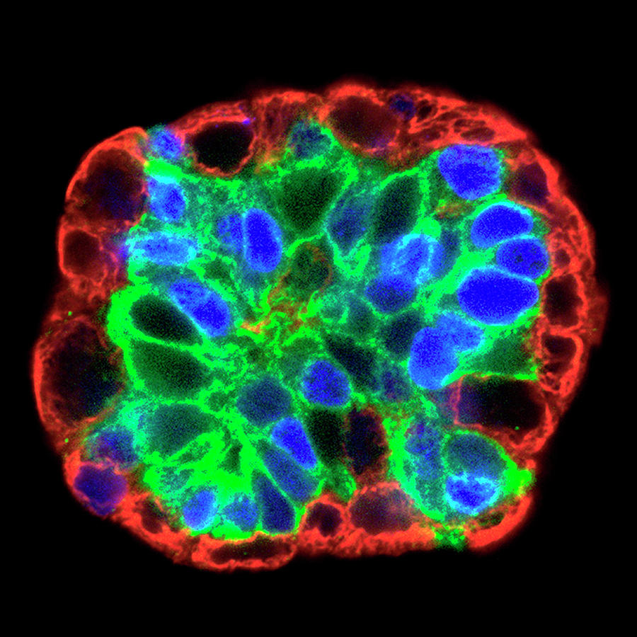 Cell Photograph - Breast Cancer Stem Cell Culture by Salk Institute/national Cancer Institute/science Photo Library