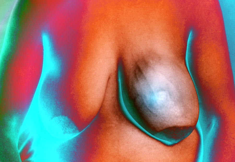 Breast Cancer Photograph by Zephyr/science Photo Library