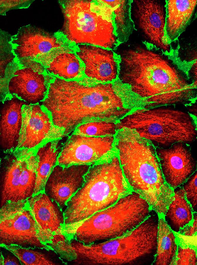 Breast Epithelial Cells Photograph by Daniel Schroen, Cell Applications Inc