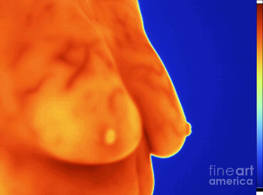 Breast Thermography Photograph by GIPhotoStock