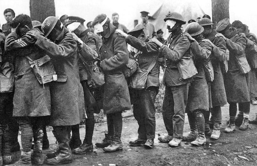 Gassed Photograph - British 55th Division gas casualties by Unknown