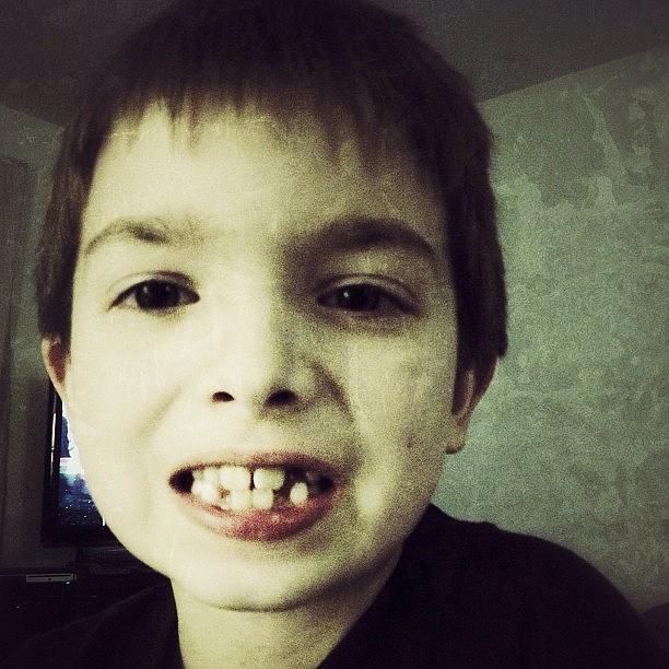 Snaggletooth Photograph - Bro Just Lost Another Tooth. He Loves by Lars Woodward