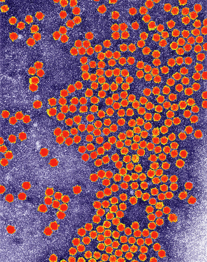 Broad Bean Wilt Virus Photograph by Centre For Bioimaging, Rothamsted ...