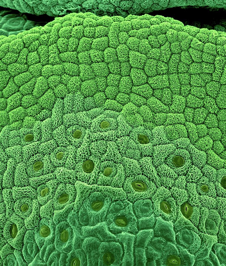 Broccoli Apical And Differentiating Meristem Photograph by Dennis Kunkel Microscopy/science Photo Library