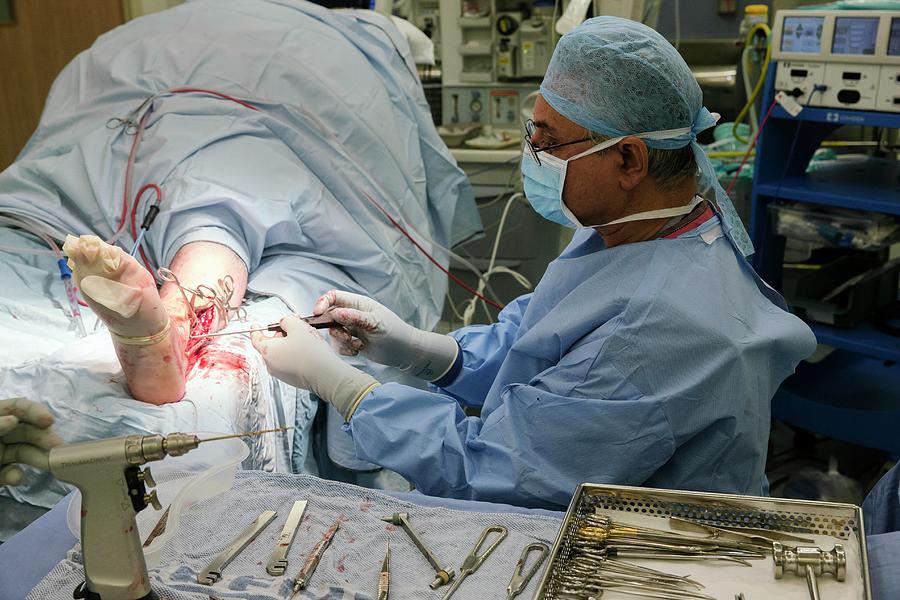 Broken Ankle Surgery Photograph by Mark Thomas/science Photo Library