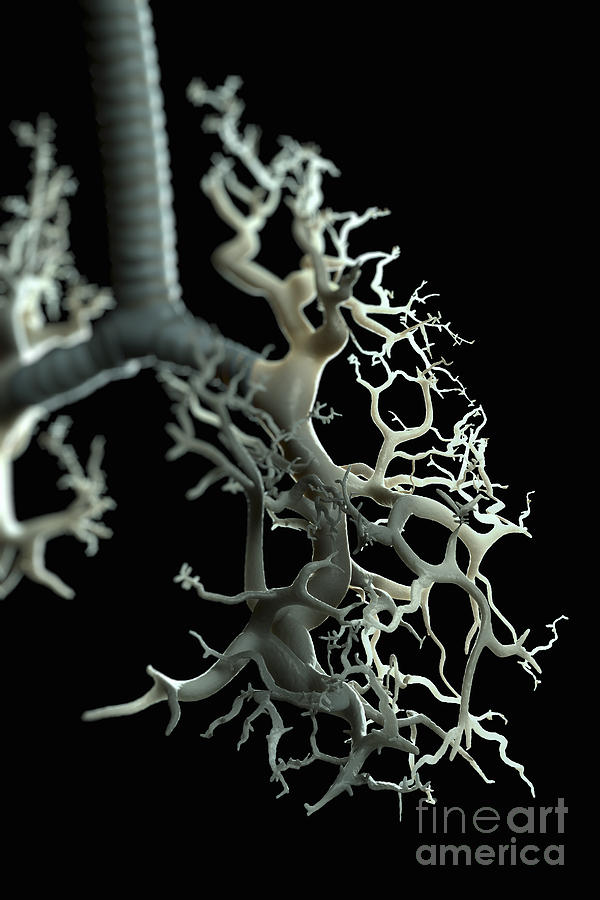 Bronchial Branches Photograph By Science Picture Co Fine Art America