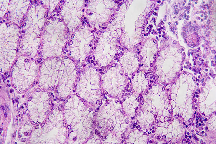 Brunner?s Brunner Glands Of The Duodenum With Their