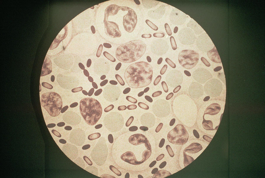 Bubonic Plague Bacteria Photograph by Pr. J. De Brux/cnri/science Photo Library