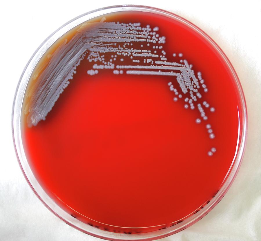 Burkholderia Pseudomallei Bacteria By Cdc/science Photo Library