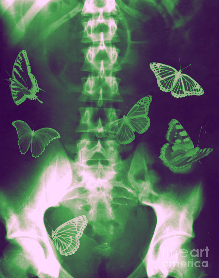 Butterflies in the stomach Photograph by Guy Viner