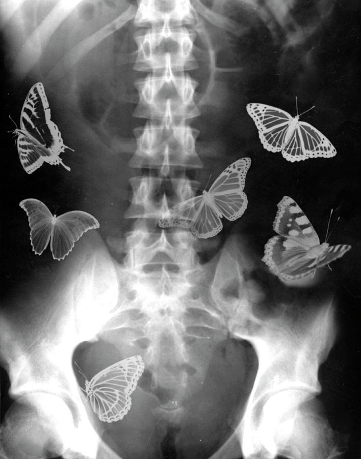 Animal Photograph - Butterflies In The Stomach by Photostock-israel