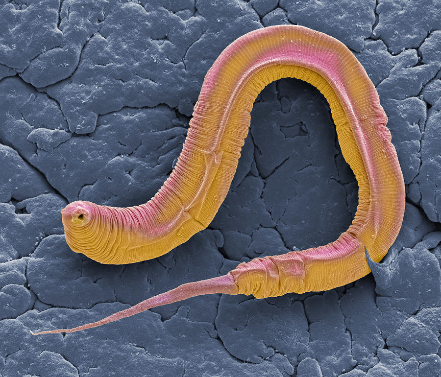 C elegans, SEM Photograph by Steve Gschmeissner/science Photo Library