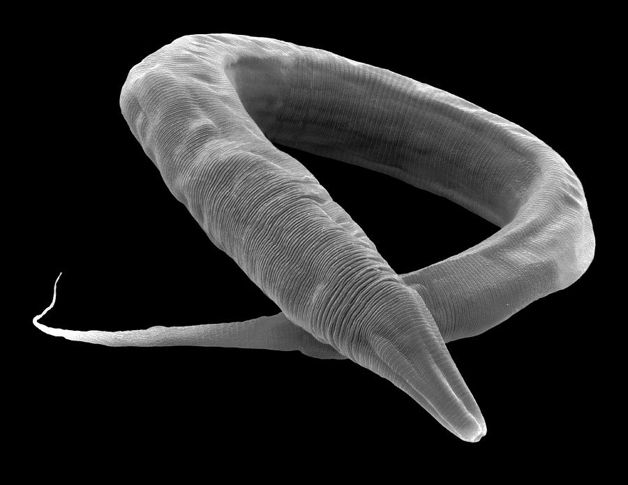 C. Elegans Worm Photograph by Steve Gschmeissner/science Photo Library ...