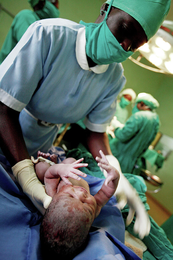 Caesarean Section Photograph by Science Photo Library - Pixels