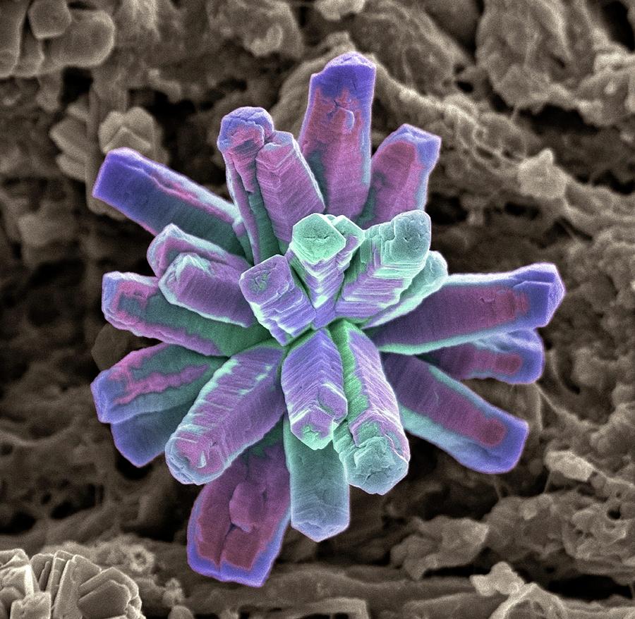 Calcium Phosphate Crystal Photograph by Steve Gschmeissner