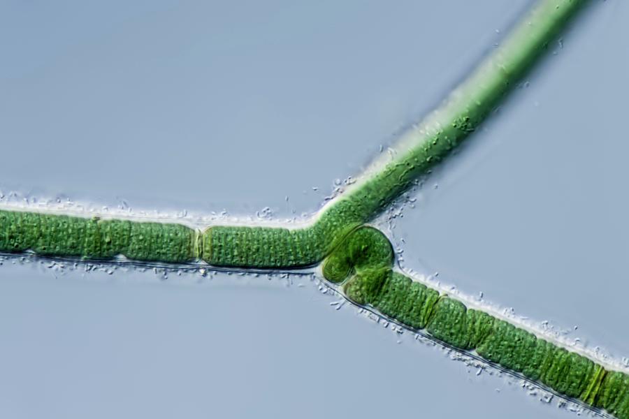 Calothrix Cyanobacterium Photograph by Gerd Guenther