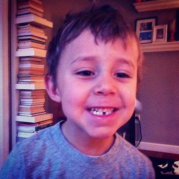 Calvin Lost His First Tooth! Photograph by Logan Gentry