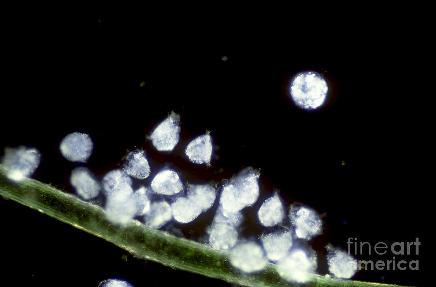 Microorganism Photograph - Campanella On Algae by Tom Branch