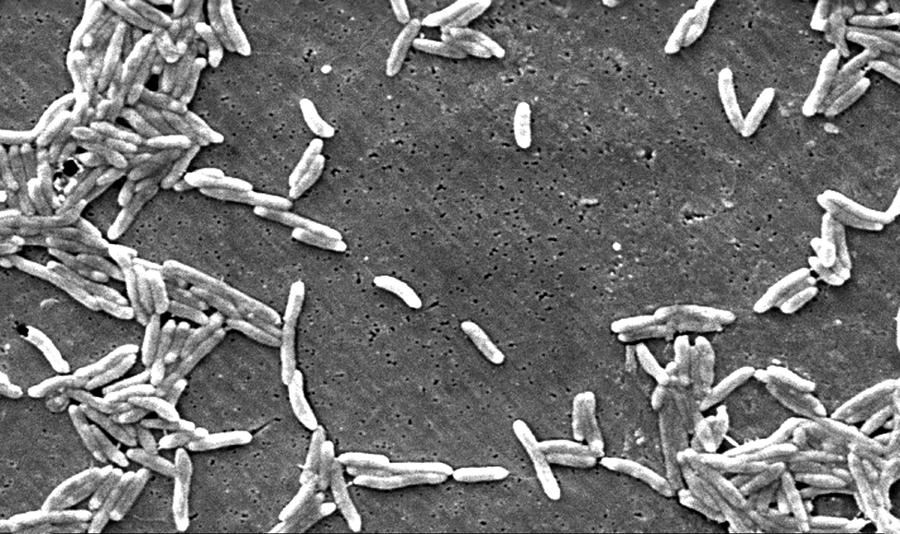 Campylobacter Fetus Bacteria, Sem Photograph by Science Source