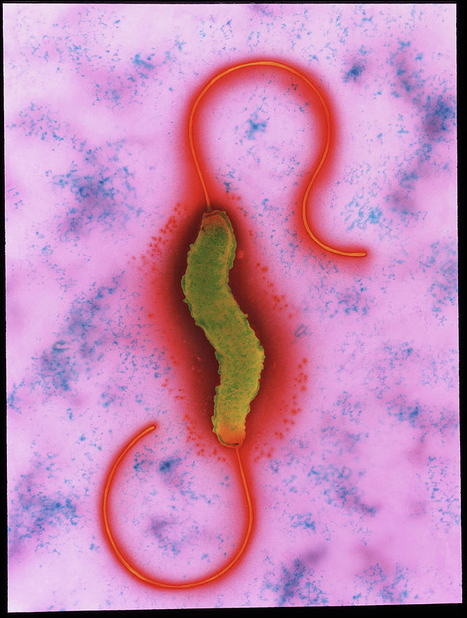 Campylobacter Jejuni Bacterium Photograph by A. Dowsett, Health Protection Agency/science Photo Library