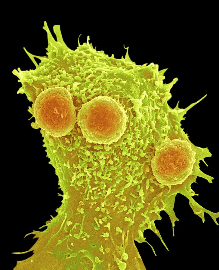 Cancer Cell And T Lymphocytes Photograph by Steve Gschmeissner